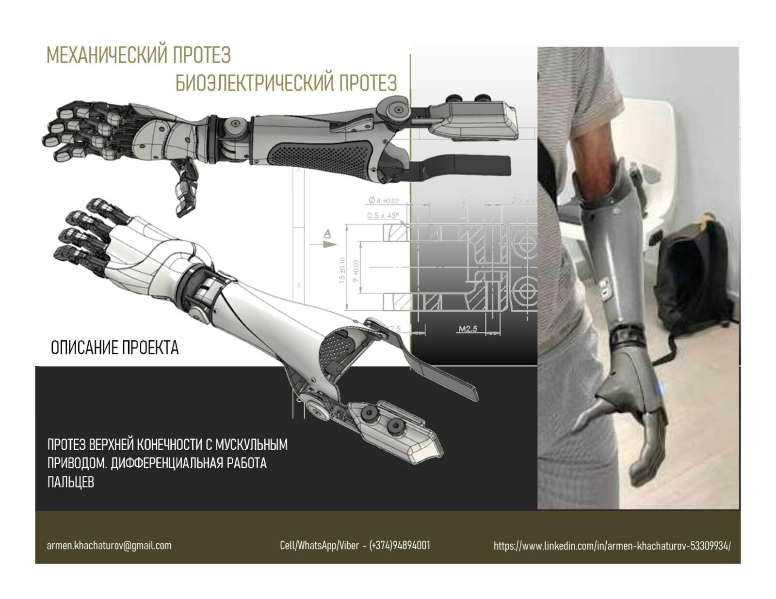 Upper-limb prostheses