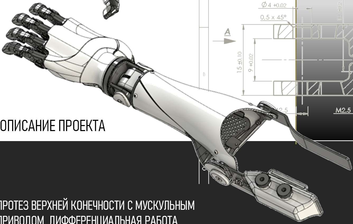 Upper-limb prostheses